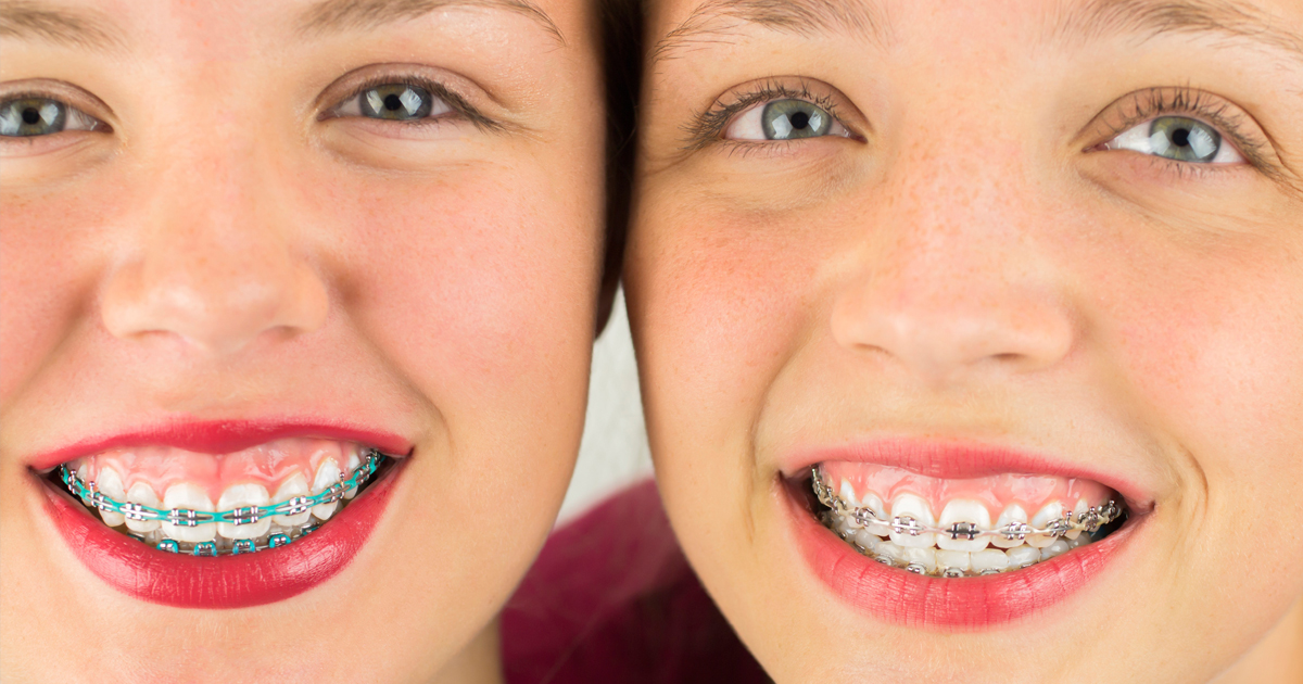 dca-blog_article-36_choose-an-orthodontist_1200x630