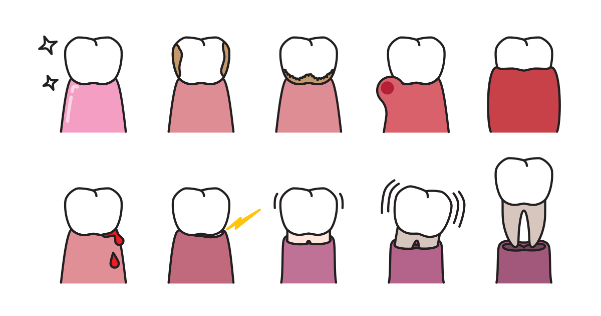 dca-blog_article-37_periodontal-disease_1200x630
