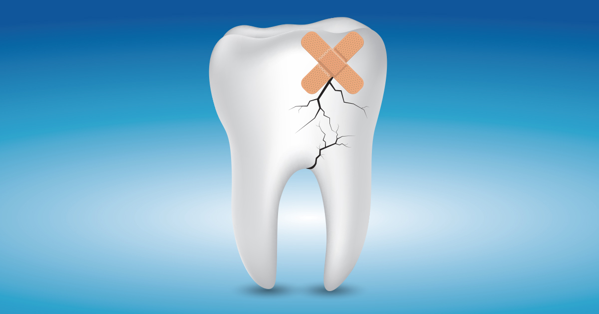dca-blog_article-41_knocked-out-tooth_1200x630