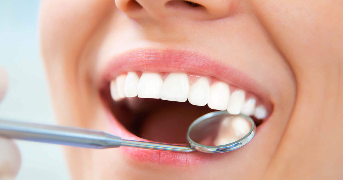 dca-blog-262-Dental-Sealants_1200x630